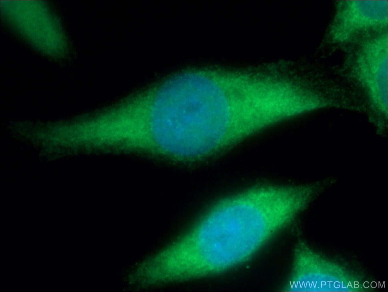 Immunofluorescence (IF) / fluorescent staining of HeLa cells using KCNAB1 Polyclonal antibody (14697-1-AP)