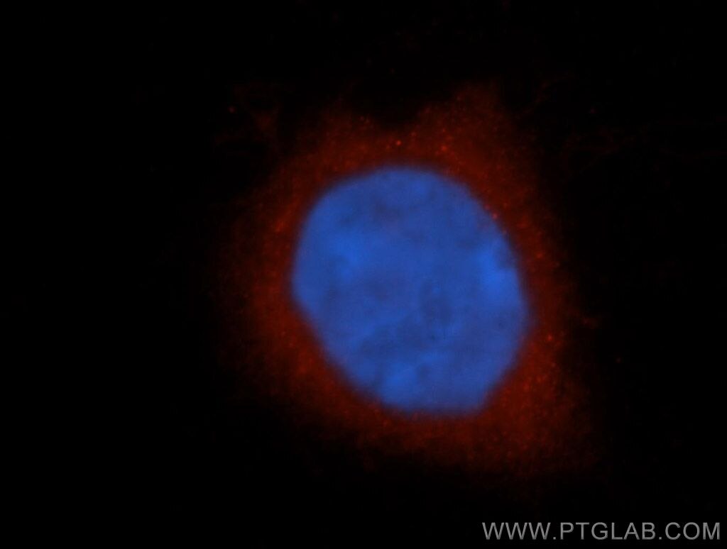 Immunofluorescence (IF) / fluorescent staining of HeLa cells using KCNAB1 Polyclonal antibody (14697-1-AP)