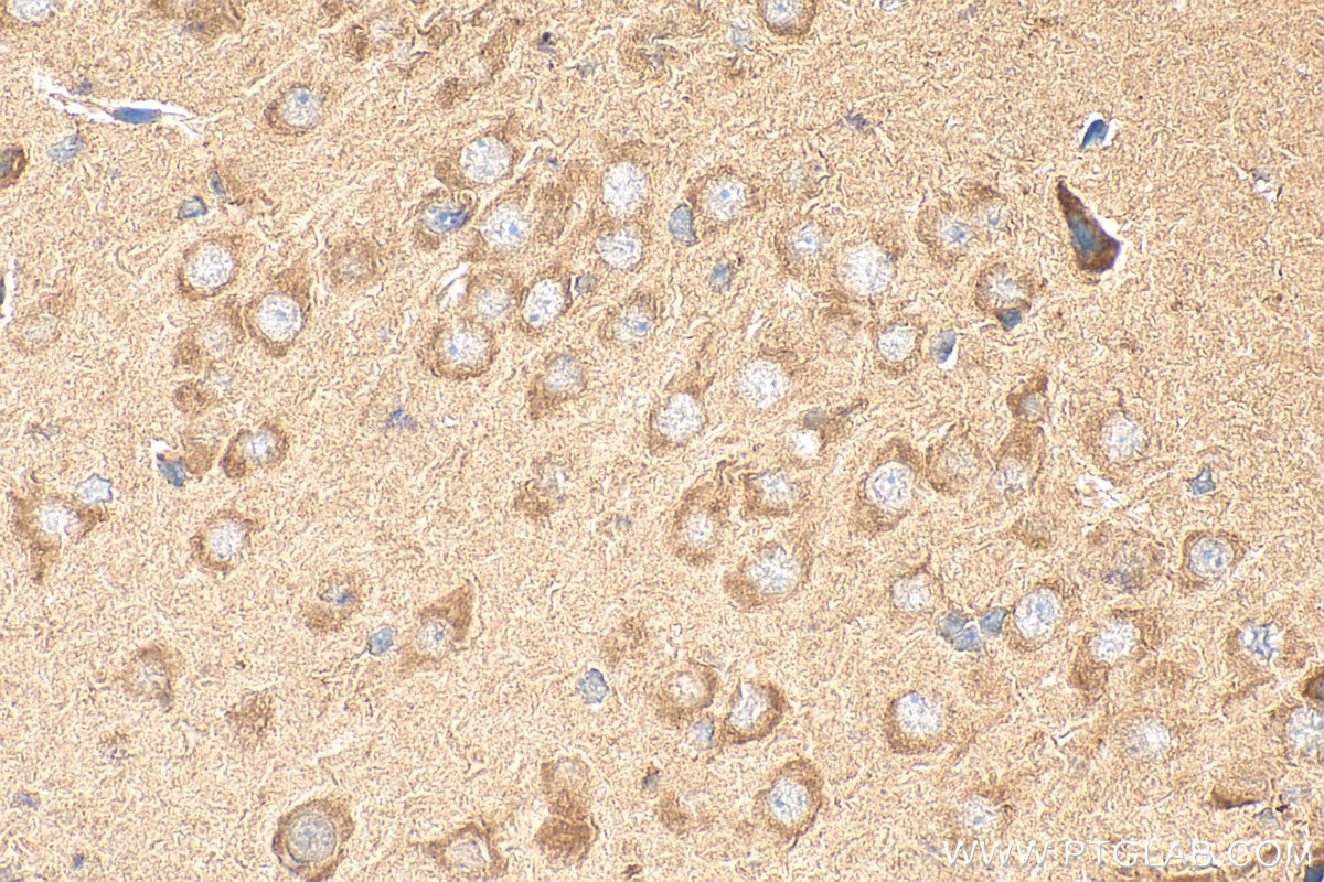 Immunohistochemistry (IHC) staining of rat brain tissue using KCNAB1 Polyclonal antibody (14697-1-AP)