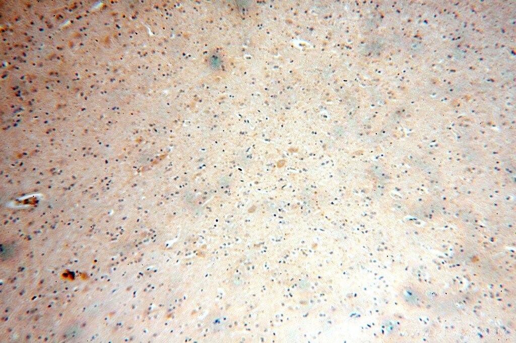 Immunohistochemistry (IHC) staining of human brain tissue using KCNAB1 Polyclonal antibody (14697-1-AP)