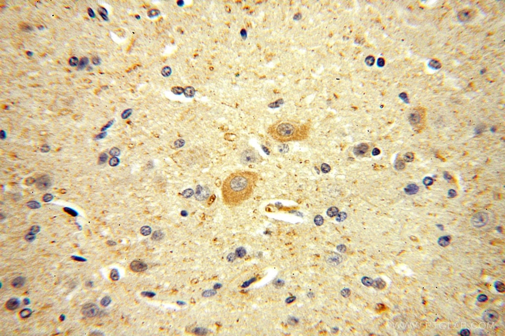 Immunohistochemistry (IHC) staining of human brain tissue using KCNAB1 Polyclonal antibody (14697-1-AP)