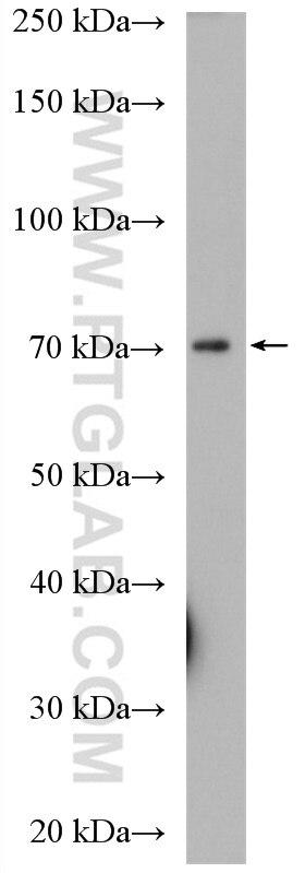 Western Blot (WB) analysis of Neuro-2a cells using KCNAB1 Polyclonal antibody (14697-1-AP)