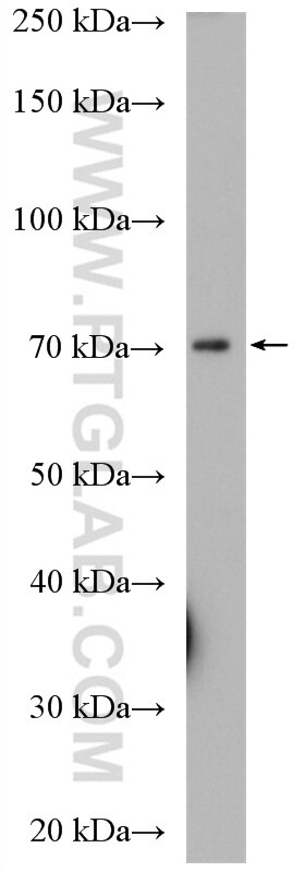 WB analysis of Neuro-2a using 14697-1-AP