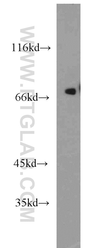 Western Blot (WB) analysis of mouse heart tissue using KCNAB1 Polyclonal antibody (14697-1-AP)
