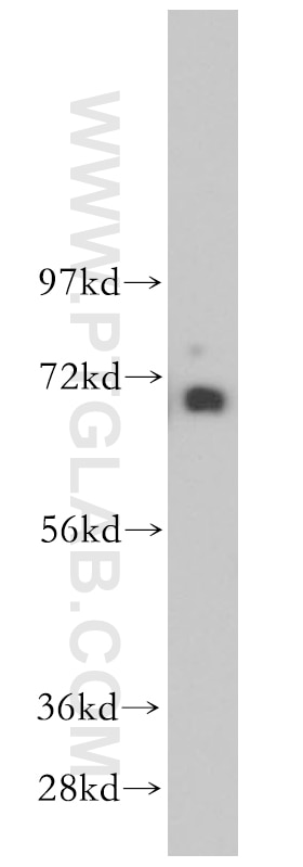 KCNAB1