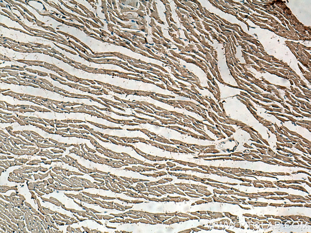 Immunohistochemistry (IHC) staining of mouse heart tissue using KCNAB2 Polyclonal antibody (17890-1-AP)