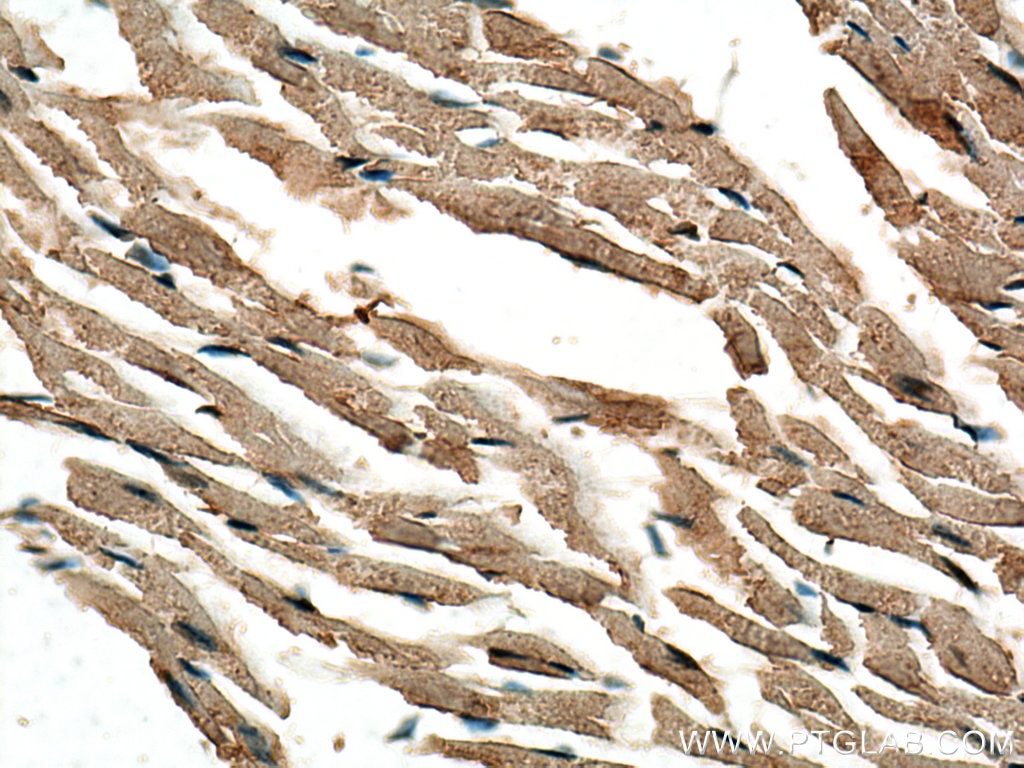 Immunohistochemistry (IHC) staining of mouse heart tissue using KCNAB2 Polyclonal antibody (17890-1-AP)