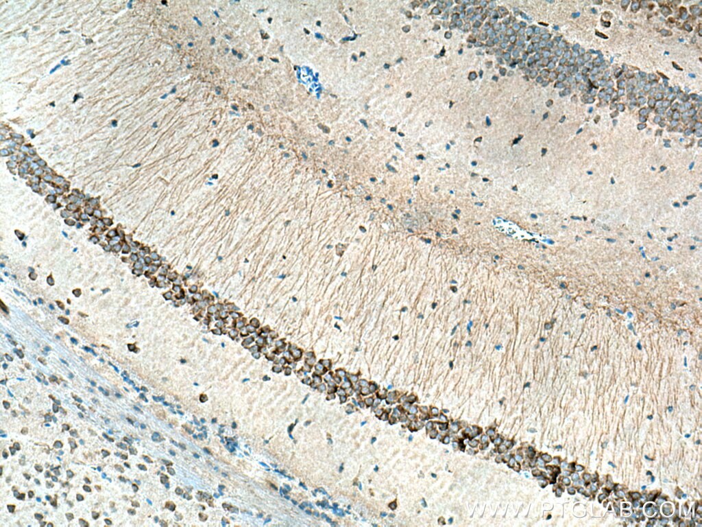 Immunohistochemistry (IHC) staining of mouse brain tissue using KCNAB2 Polyclonal antibody (17890-1-AP)