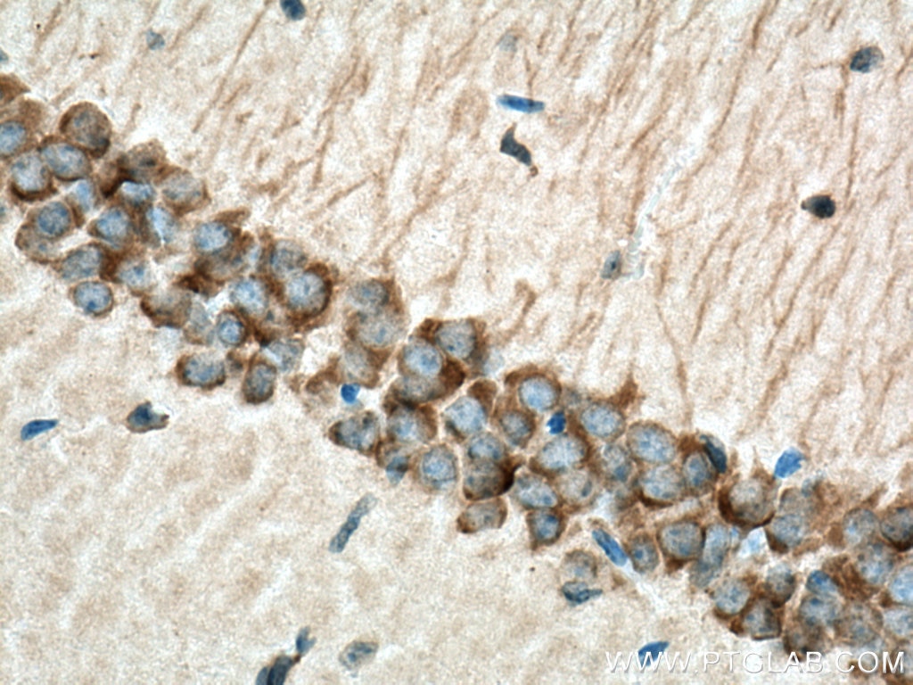 Immunohistochemistry (IHC) staining of mouse brain tissue using KCNAB2 Polyclonal antibody (17890-1-AP)