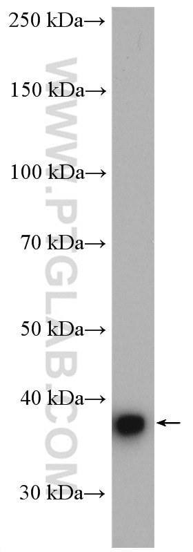 Western Blot (WB) analysis of mouse brain tissue using KCNAB2 Polyclonal antibody (17890-1-AP)