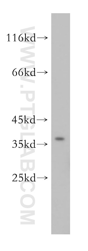 Western Blot (WB) analysis of HepG2 cells using KCNAB2 Polyclonal antibody (17890-1-AP)