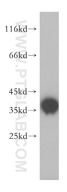 Western Blot (WB) analysis of mouse brain tissue using KCNAB2 Polyclonal antibody (17890-1-AP)