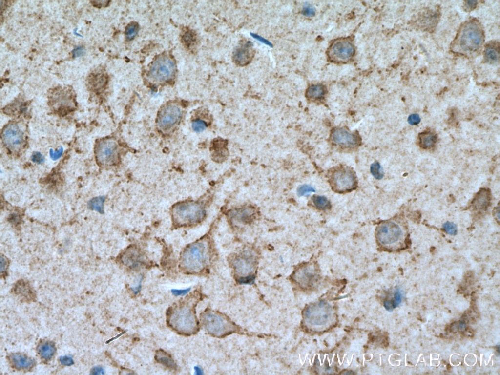 Immunohistochemistry (IHC) staining of mouse brain tissue using KCNB1-Specific Polyclonal antibody (19963-1-AP)