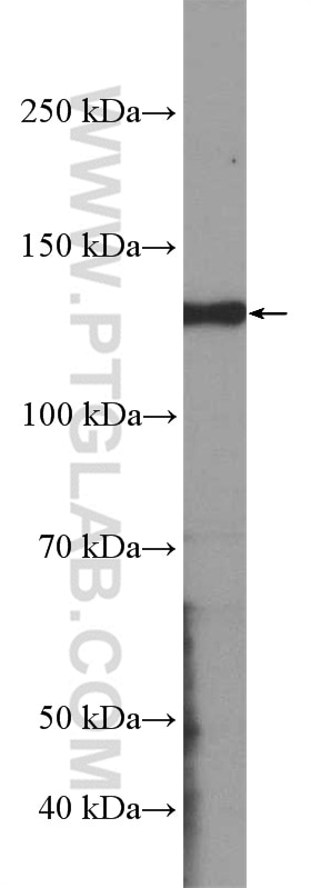 Western Blot (WB) analysis of SH-SY5Y cells using KCNB1-Specific Polyclonal antibody (19963-1-AP)