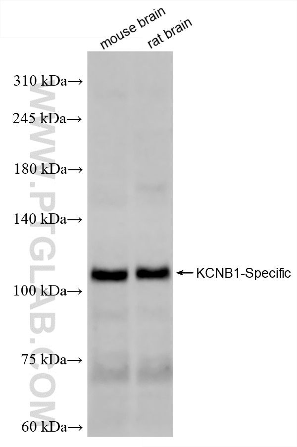 Western Blot (WB) analysis of various lysates using KCNB1-Specific Recombinant antibody (86281-1-RR)