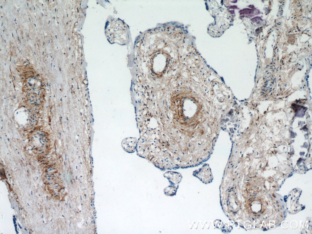 Immunohistochemistry (IHC) staining of human placenta tissue using KCNC4 Polyclonal antibody (18092-1-AP)