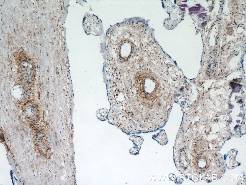 IHC staining of human placenta using 18092-1-AP