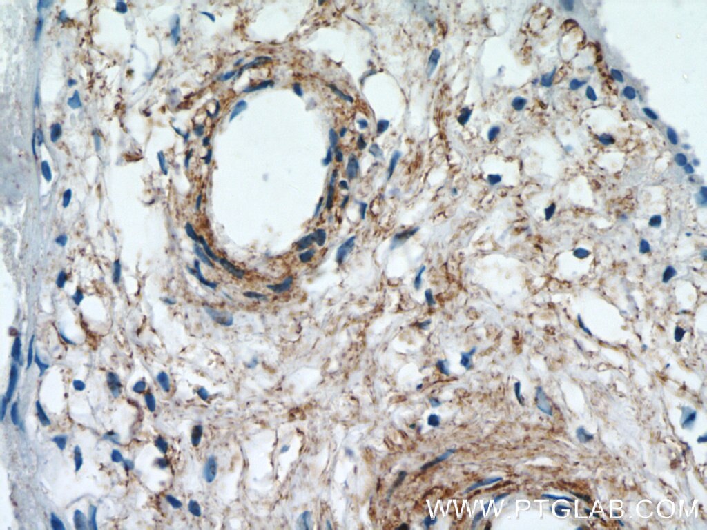 Immunohistochemistry (IHC) staining of human placenta tissue using KCNC4 Polyclonal antibody (18092-1-AP)