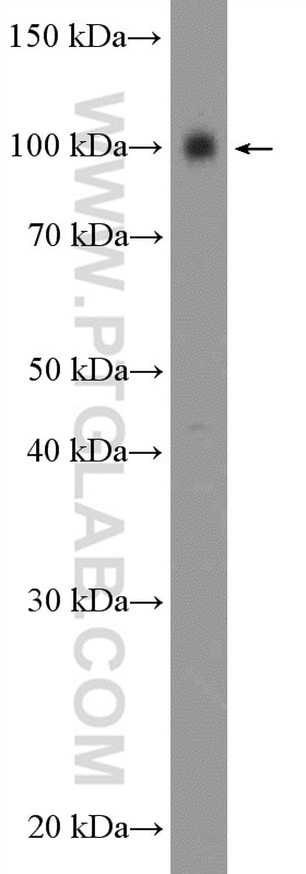 Western Blot (WB) analysis of mouse brain tissue using KCNC4 Polyclonal antibody (18092-1-AP)