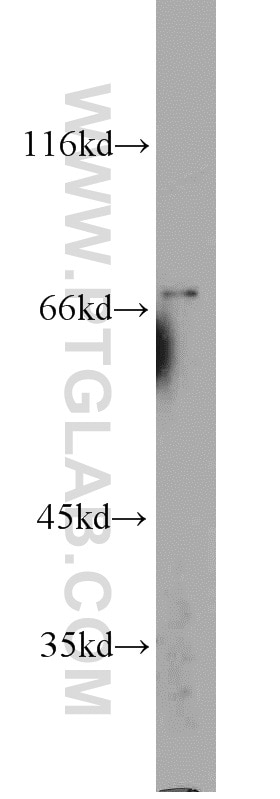 Western Blot (WB) analysis of mouse brain tissue using Kv4.1 Polyclonal antibody (13768-1-AP)