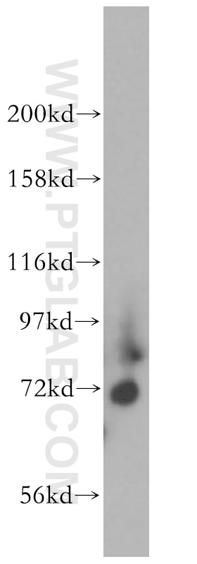 Western Blot (WB) analysis of human heart tissue using Kv4.1 Polyclonal antibody (13768-1-AP)
