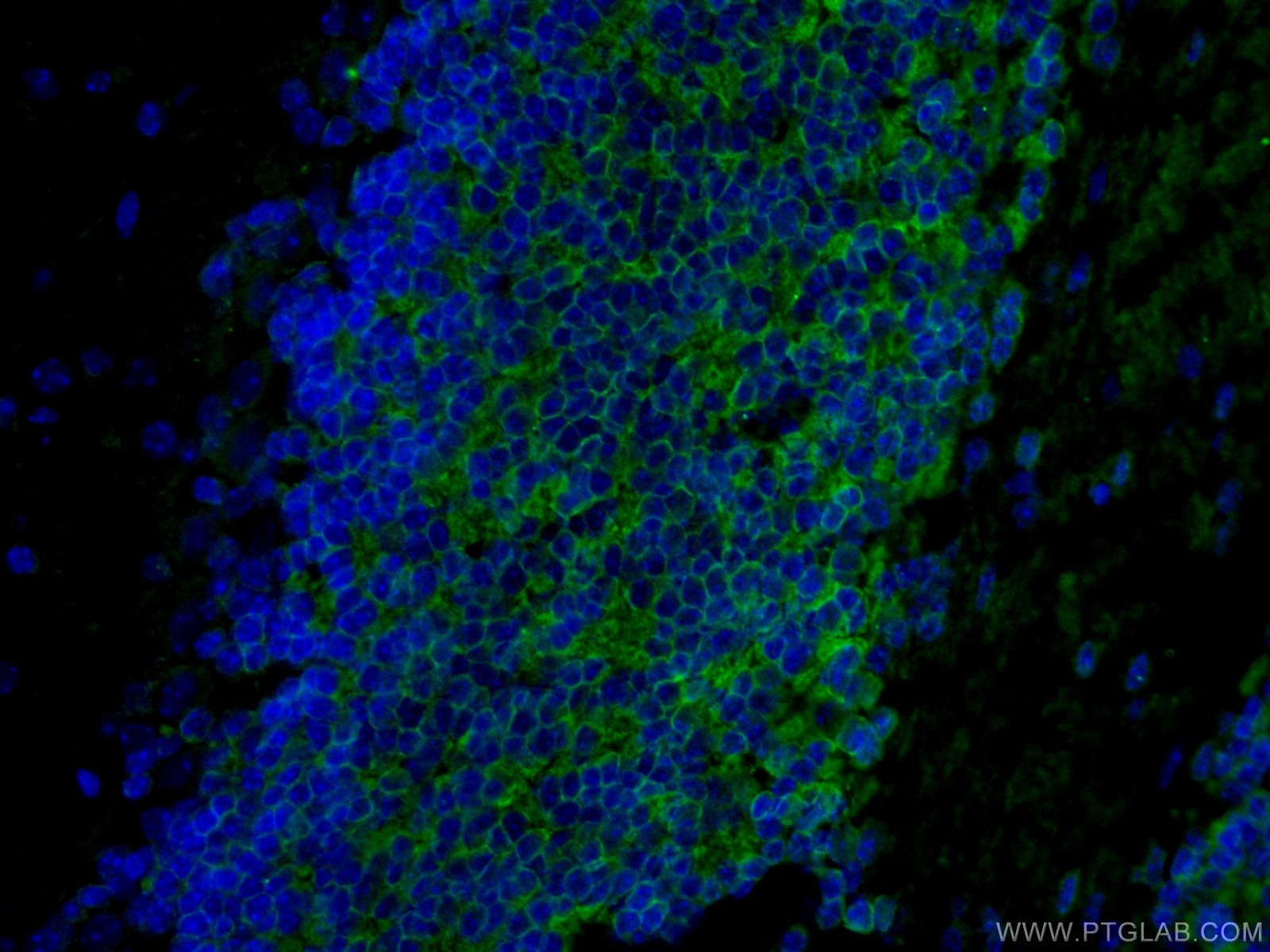 Immunofluorescence (IF) / fluorescent staining of mouse brain tissue using Kv4.2 Polyclonal antibody (21298-1-AP)