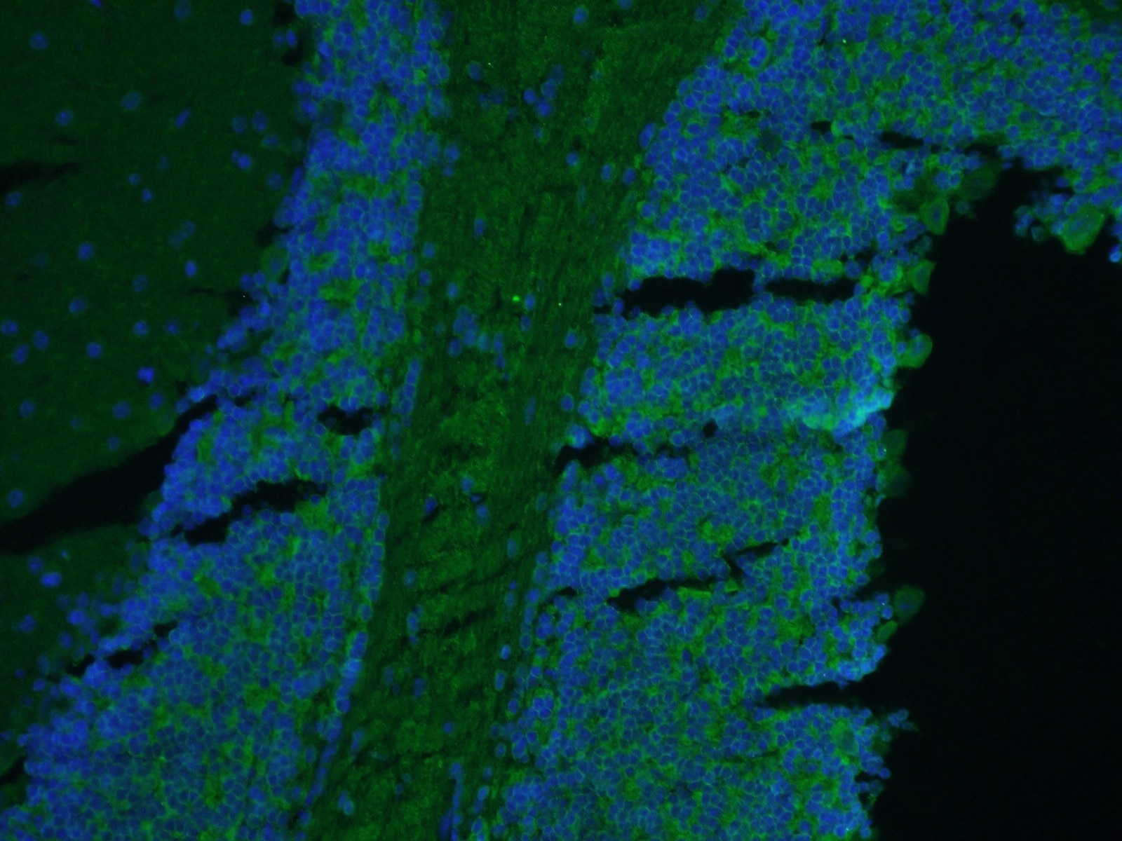 Immunofluorescence (IF) / fluorescent staining of mouse brain tissue using Kv4.2 Polyclonal antibody (21298-1-AP)