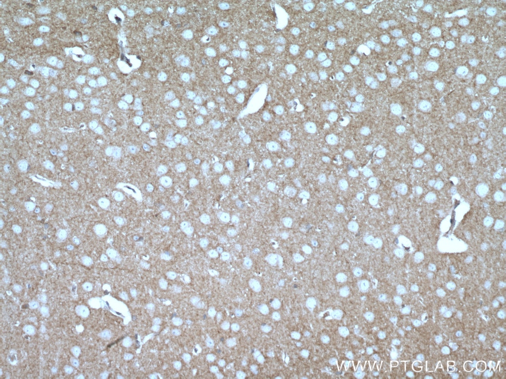 Immunohistochemistry (IHC) staining of mouse brain tissue using Kv4.2 Polyclonal antibody (21298-1-AP)