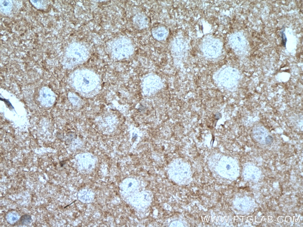 Immunohistochemistry (IHC) staining of mouse brain tissue using Kv4.2 Polyclonal antibody (21298-1-AP)