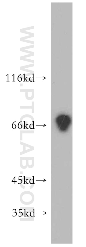 Western Blot (WB) analysis of HeLa cells using Kv4.2 Polyclonal antibody (21298-1-AP)