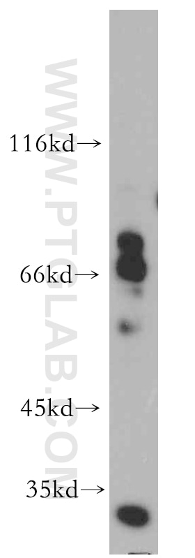 Western Blot (WB) analysis of DU 145 cells using Kv4.2 Polyclonal antibody (21298-1-AP)