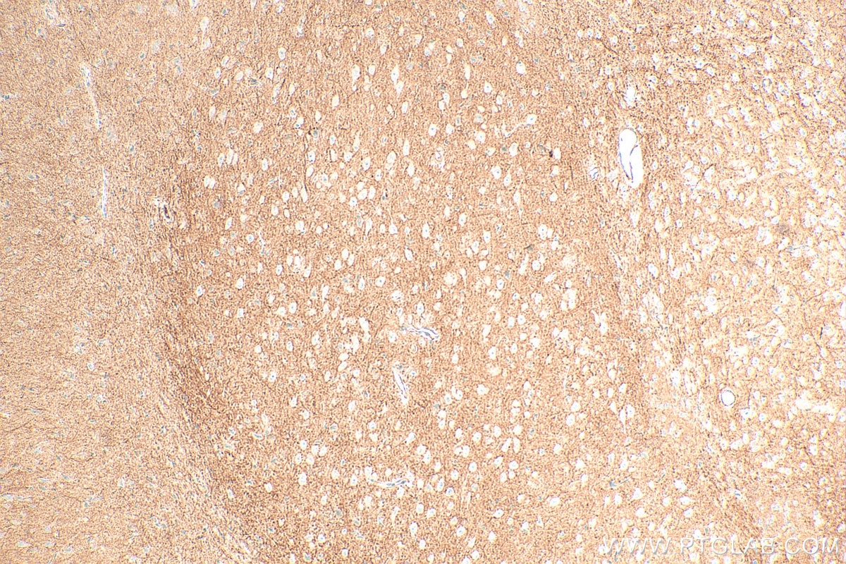 Immunohistochemistry (IHC) staining of rat brain tissue using KCND3 Polyclonal antibody (25468-1-AP)