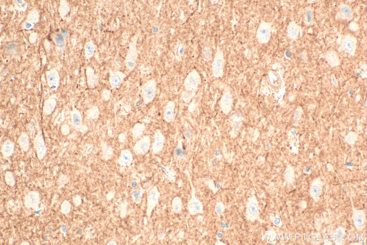 Immunohistochemistry (IHC) staining of rat brain tissue using KCND3 Polyclonal antibody (25468-1-AP)