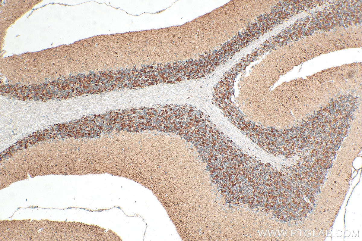 Immunohistochemistry (IHC) staining of mouse cerebellum tissue using KCND3 Polyclonal antibody (25468-1-AP)