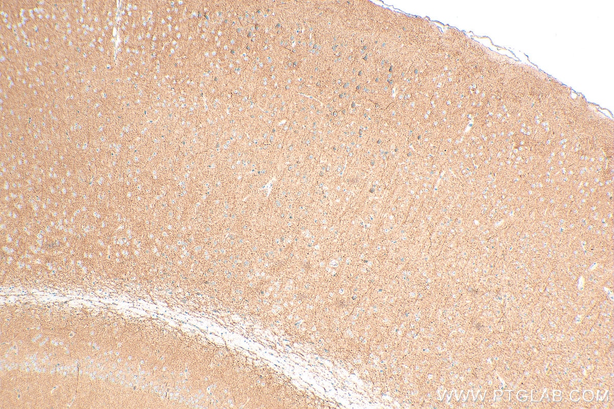 Immunohistochemistry (IHC) staining of mouse brain tissue using KCND3 Polyclonal antibody (25468-1-AP)