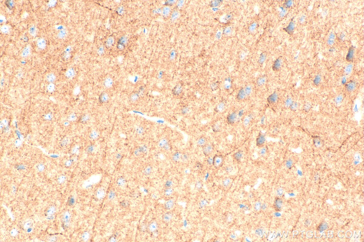 Immunohistochemistry (IHC) staining of mouse brain tissue using KCND3 Polyclonal antibody (25468-1-AP)