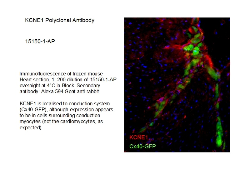 Immunofluorescence (IF) / fluorescent staining of mouse heart tissue using KCNE1 Polyclonal antibody (15150-1-AP)