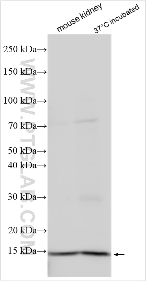 Western Blot (WB) analysis of various lysates using KCNE1 Polyclonal antibody (15150-1-AP)