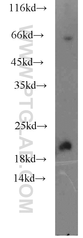 Western Blot (WB) analysis of mouse heart tissue using KCNE1 Polyclonal antibody (15150-1-AP)