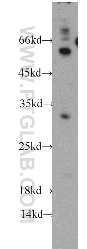 Western Blot (WB) analysis of mouse testis tissue using KCNE1 Polyclonal antibody (15150-1-AP)