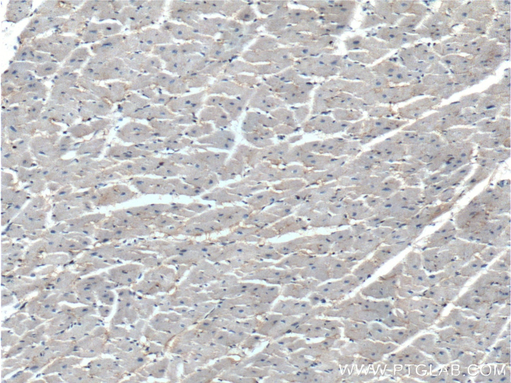 IHC staining of human heart using 13867-1-AP