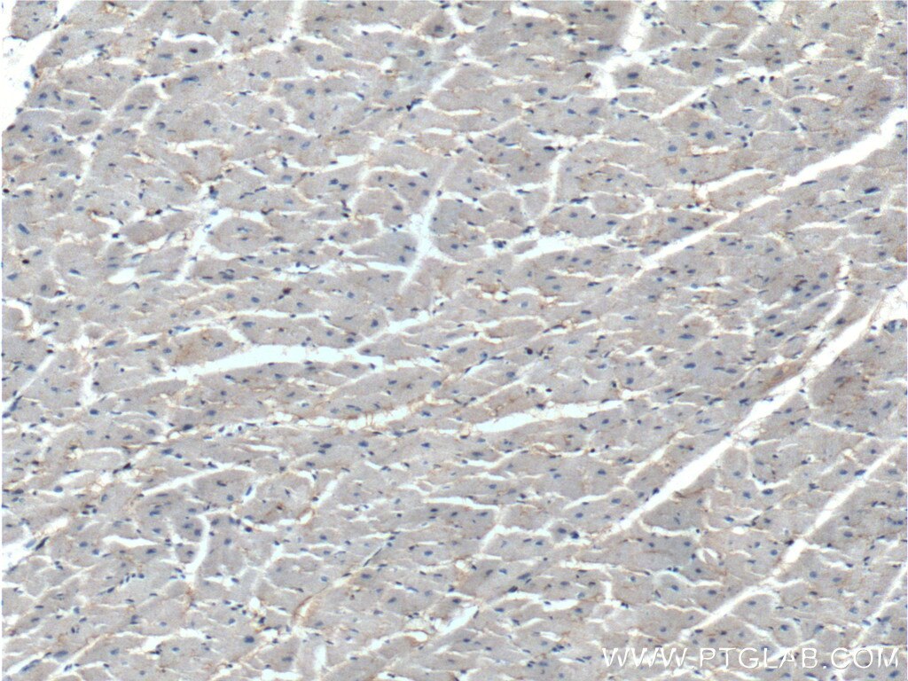 Immunohistochemistry (IHC) staining of human heart tissue using KCNE1L Polyclonal antibody (13867-1-AP)