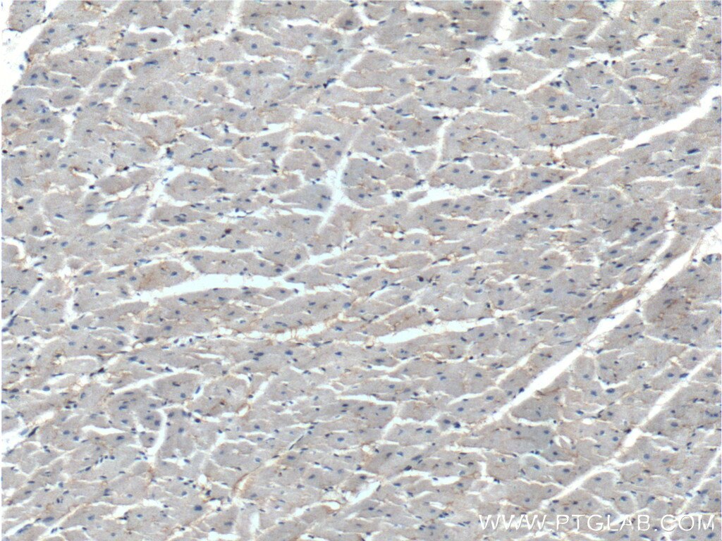 Immunohistochemistry (IHC) staining of human heart tissue using KCNE1L Polyclonal antibody (13867-1-AP)