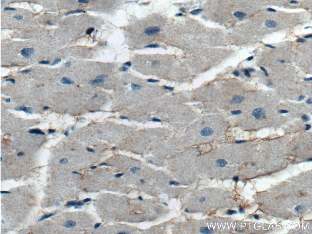 IHC staining of human heart using 13867-1-AP
