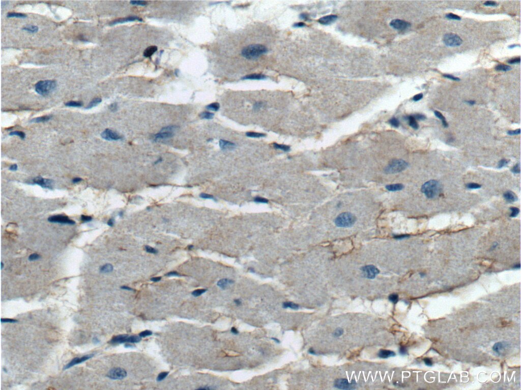 Immunohistochemistry (IHC) staining of human heart tissue using KCNE1L Polyclonal antibody (13867-1-AP)