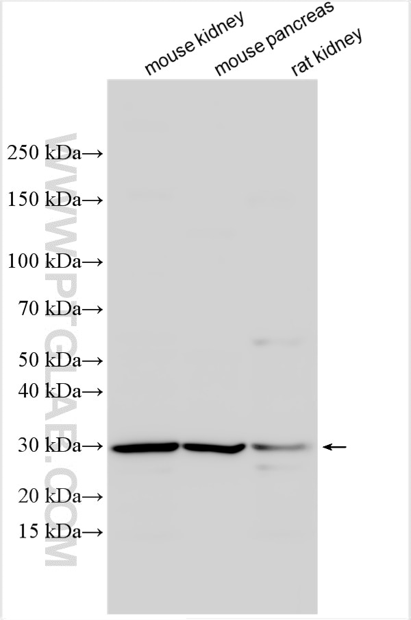 Western Blot (WB) analysis of various lysates using KCNE2 Polyclonal antibody (17920-1-AP)