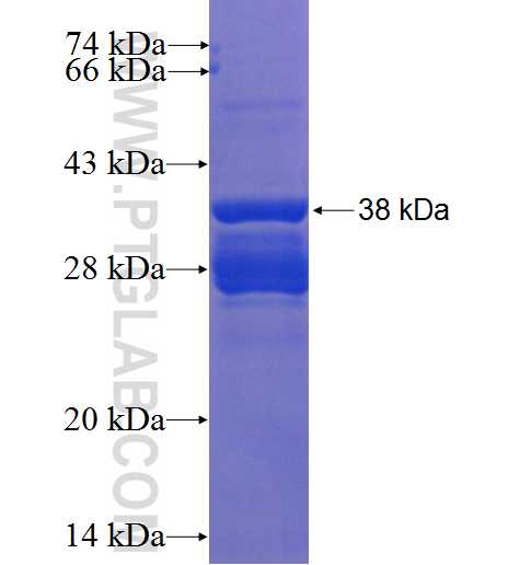 KCNE3 fusion protein Ag4145 SDS-PAGE