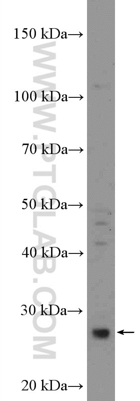 Western Blot (WB) analysis of L02 cells using KCNE4 Polyclonal antibody (18289-1-AP)