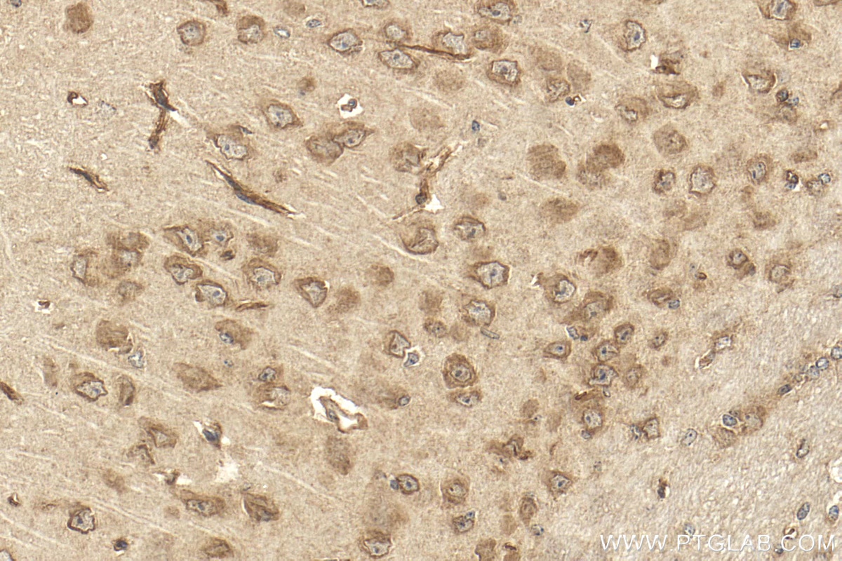 Immunohistochemistry (IHC) staining of mouse brain tissue using KCNH1 Polyclonal antibody (26426-1-AP)