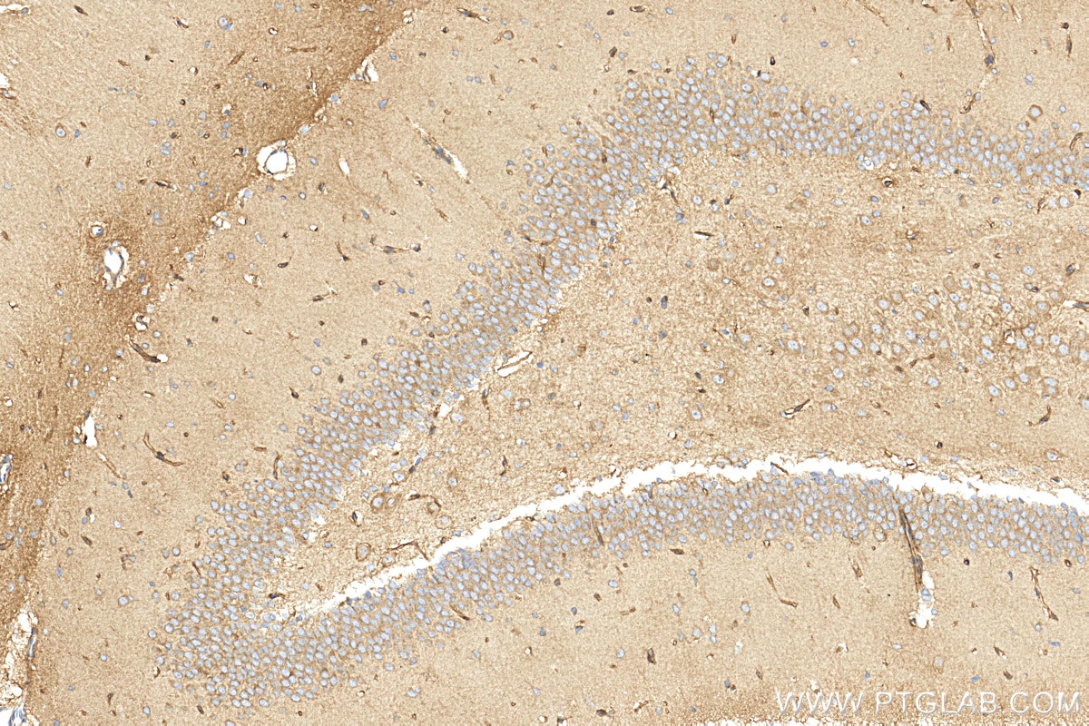Immunohistochemistry (IHC) staining of rat brain tissue using KCNH1 Polyclonal antibody (26426-1-AP)